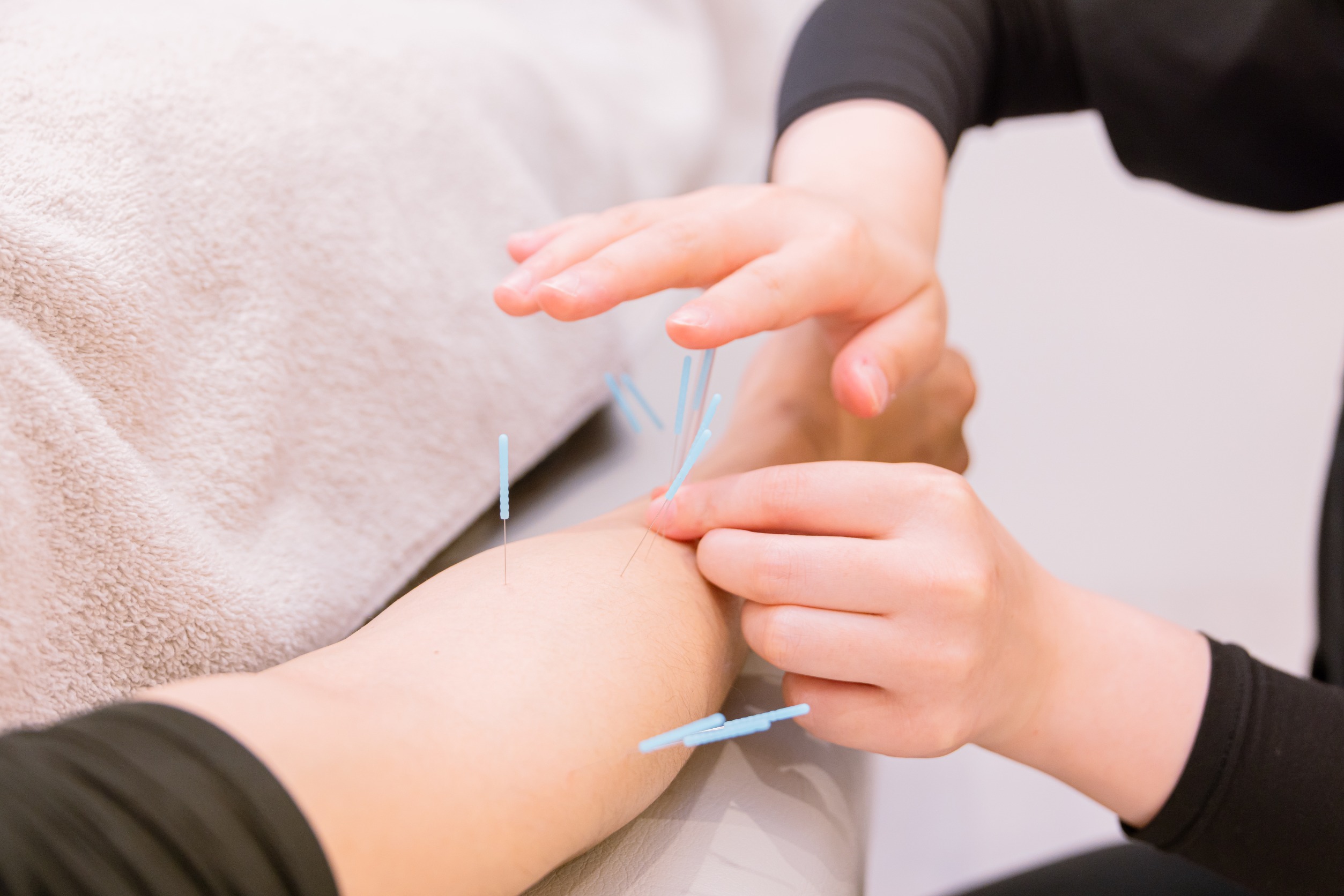 針を背中に打っている